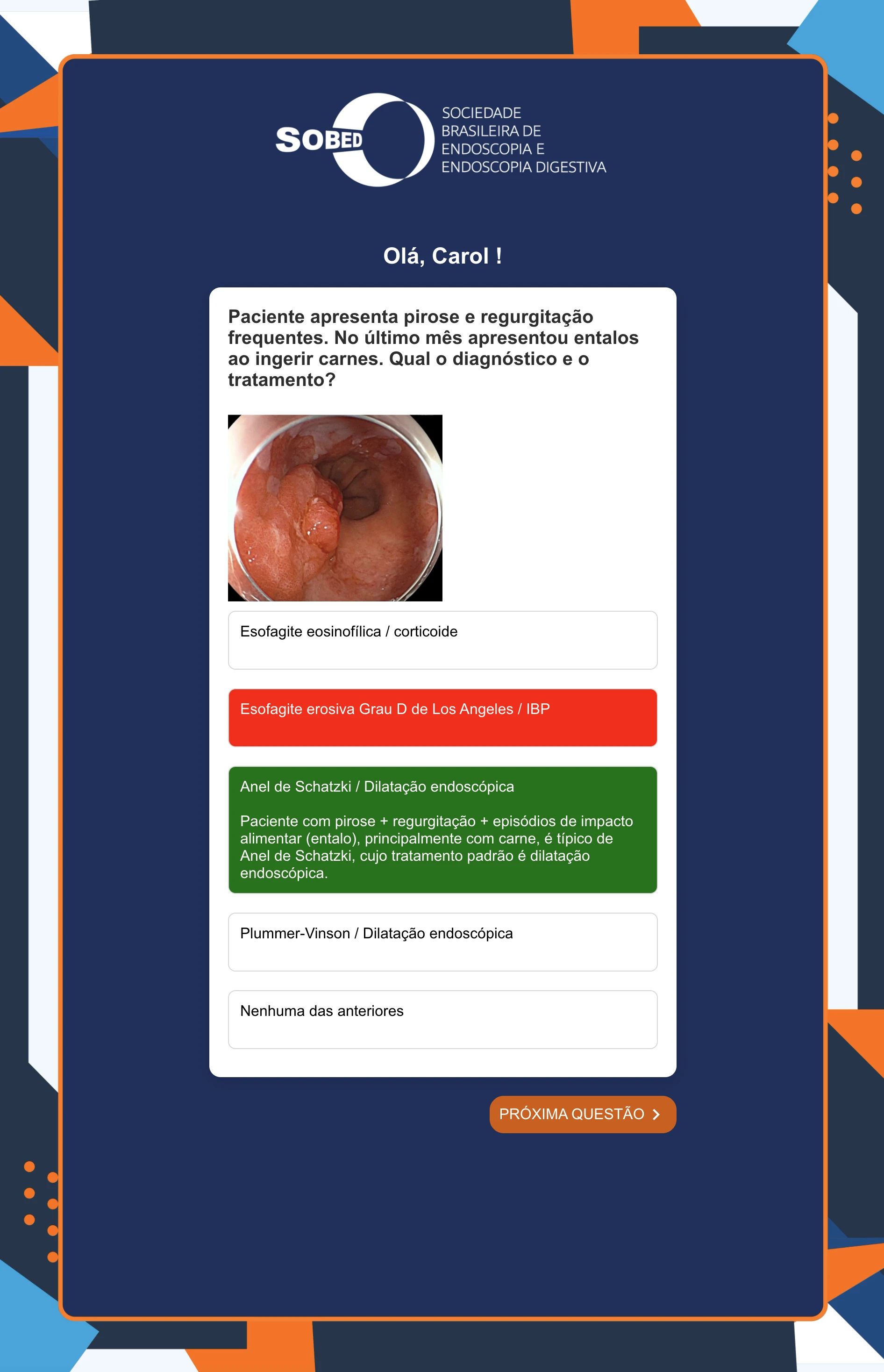 Ativação Quiz Interativo